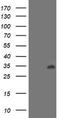 Lactamase Beta 2 antibody, LS-C172758, Lifespan Biosciences, Western Blot image 