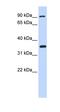 Inhibitor Of Nuclear Factor Kappa B Kinase Subunit Beta antibody, orb329679, Biorbyt, Western Blot image 