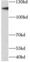Minichromosome Maintenance Complex Component 2 antibody, FNab05057, FineTest, Western Blot image 