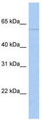 Poly(A) RNA polymerase GLD2 antibody, TA330997, Origene, Western Blot image 