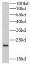 Epiregulin antibody, FNab10012, FineTest, Western Blot image 