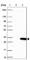 Chromosome 6 Open Reading Frame 62 antibody, HPA030566, Atlas Antibodies, Western Blot image 