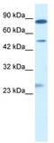 Chloride Intracellular Channel 6 antibody, TA338724, Origene, Western Blot image 