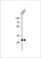 CCR4-NOT Transcription Complex Subunit 8 antibody, MBS9201317, MyBioSource, Western Blot image 