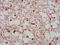 Polycomb Group Ring Finger 1 antibody, LS-C672466, Lifespan Biosciences, Immunohistochemistry paraffin image 