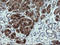 Cyclin Dependent Kinase Inhibitor 2B antibody, LS-C174218, Lifespan Biosciences, Immunohistochemistry paraffin image 