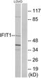 Interferon-induced protein with tetratricopeptide repeats 1 antibody, A02652, Boster Biological Technology, Western Blot image 