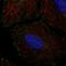 ER Membrane Protein Complex Subunit 4 antibody, HPA026868, Atlas Antibodies, Immunofluorescence image 