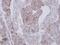 NADH:Ubiquinone Oxidoreductase Core Subunit S2 antibody, PA5-22364, Invitrogen Antibodies, Immunohistochemistry frozen image 