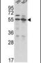 Transmembrane Serine Protease 2 antibody, PA5-14264, Invitrogen Antibodies, Western Blot image 