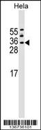 Anti-Silencing Function 1A Histone Chaperone antibody, 59-015, ProSci, Western Blot image 