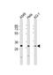 Pyrroline-5-Carboxylate Reductase 3 antibody, M32428, Boster Biological Technology, Western Blot image 