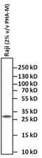 CD69 Molecule antibody, MA1-207, Invitrogen Antibodies, Western Blot image 