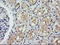 Component Of Oligomeric Golgi Complex 6 antibody, LS-C337878, Lifespan Biosciences, Immunohistochemistry paraffin image 