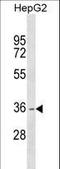 Dehydrogenase/Reductase 1 antibody, LS-C159455, Lifespan Biosciences, Western Blot image 