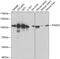 Proteasome 26S Subunit, Non-ATPase 2 antibody, 18-436, ProSci, Western Blot image 