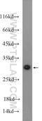 Metaxin 2 antibody, 11610-1-AP, Proteintech Group, Western Blot image 