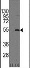 Syncytin antibody, PA5-12286, Invitrogen Antibodies, Western Blot image 