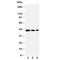 Aquaporin 2 antibody, R30832, NSJ Bioreagents, Western Blot image 