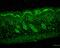 Protein Disulfide Isomerase Family A Member 3 antibody, M01464-1, Boster Biological Technology, Immunohistochemistry paraffin image 