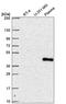 SPT7 Like, STAGA Complex Gamma Subunit antibody, HPA063643, Atlas Antibodies, Western Blot image 