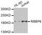 RB Binding Protein 6, Ubiquitin Ligase antibody, STJ29046, St John