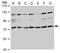 Transforming Acidic Coiled-Coil Containing Protein 2 antibody, GTX110516, GeneTex, Western Blot image 