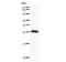 Nuclear Receptor Interacting Protein 1 antibody, LS-C342507, Lifespan Biosciences, Western Blot image 