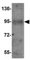 Calcium Release Activated Channel Regulator 2A antibody, GTX85142, GeneTex, Western Blot image 