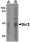 Sirtuin 2 antibody, orb74947, Biorbyt, Western Blot image 
