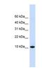 D-Dopachrome Tautomerase antibody, NBP1-53202, Novus Biologicals, Western Blot image 