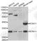 Potassium Voltage-Gated Channel Subfamily J Member 11 antibody, A5765, ABclonal Technology, Western Blot image 