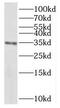 Serine/threonine-protein phosphatase 6 catalytic subunit antibody, FNab06736, FineTest, Western Blot image 