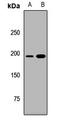 RPTOR Independent Companion Of MTOR Complex 2 antibody, orb412432, Biorbyt, Western Blot image 