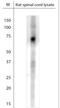 Solute Carrier Family 17 Member 6 antibody, NBP1-46534, Novus Biologicals, Western Blot image 