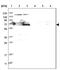 Kinesin Family Member 2B antibody, NBP1-86002, Novus Biologicals, Western Blot image 