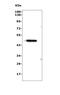 Mitochondrially Encoded NADH:Ubiquinone Oxidoreductase Core Subunit 4 antibody, A04180-2, Boster Biological Technology, Western Blot image 