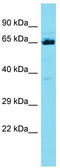 EF-Hand And Coiled-Coil Domain Containing 1 antibody, TA330752, Origene, Western Blot image 