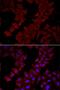 Chaperonin Containing TCP1 Subunit 4 antibody, LS-C334789, Lifespan Biosciences, Immunofluorescence image 