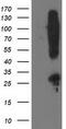 Synaptosome Associated Protein 25 antibody, M01625-1, Boster Biological Technology, Western Blot image 