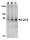 Toll Like Receptor 1 antibody, AP05230PU-N, Origene, Western Blot image 
