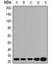 ATP Synthase Peripheral Stalk Subunit OSCP antibody, abx225053, Abbexa, Western Blot image 