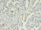 Inosine Monophosphate Dehydrogenase 2 antibody, LS-C375955, Lifespan Biosciences, Immunohistochemistry frozen image 