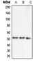 Septin 7 antibody, MBS820178, MyBioSource, Western Blot image 