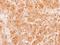 Cell Death Inducing DFFA Like Effector A antibody, GTX113166, GeneTex, Immunohistochemistry paraffin image 