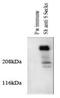 AKAP12 antibody, NBP2-66604, Novus Biologicals, Western Blot image 