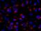Adenosine Deaminase antibody, GTX02310, GeneTex, Immunofluorescence image 
