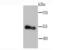 Lipoprotein Lipase antibody, NBP2-66936, Novus Biologicals, Western Blot image 