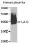 Major Histocompatibility Complex, Class I, G antibody, abx005635, Abbexa, Western Blot image 