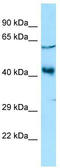 YY2 Transcription Factor antibody, TA337700, Origene, Western Blot image 